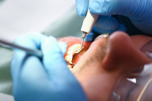 Best Emergency Treatment for Toothache in University Of Pittsburgh Johnstown, PA