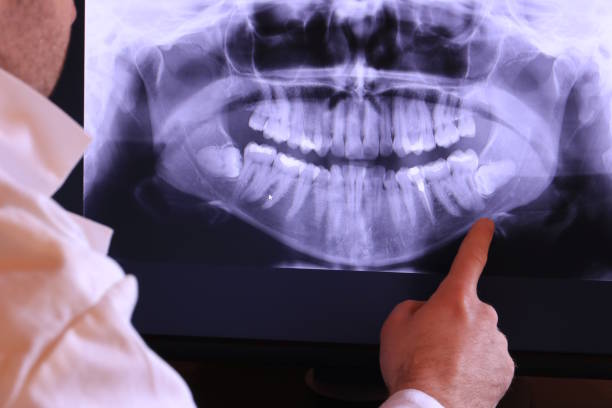 Best Emergency Tooth Extraction in University Of Pittsburgh Johnstown, PA