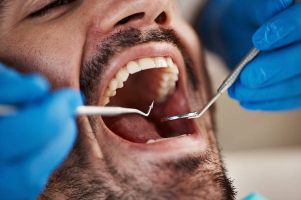 Best Emergency Dental Surgery in University Of Pittsburgh Johnstown, PA
